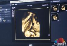 4D ultrazvuk sada moguće uraditi i u Dispanzeru za žene